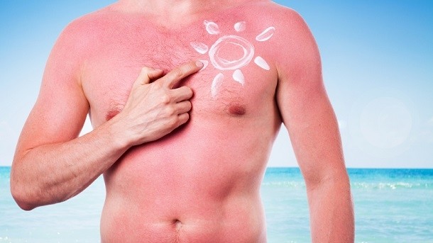 Dermatologist slams bizarre 'sunburn tattoo' trend