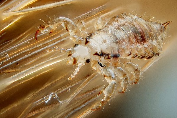 The race is on to find a more effective head lice shampoo