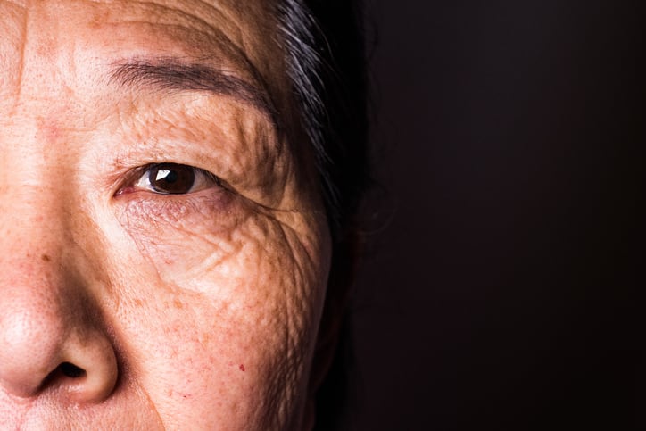 Shiseido-identifies-ring-collagen-network-as-central-to-ageing-signs-in-facial-skin.jpg