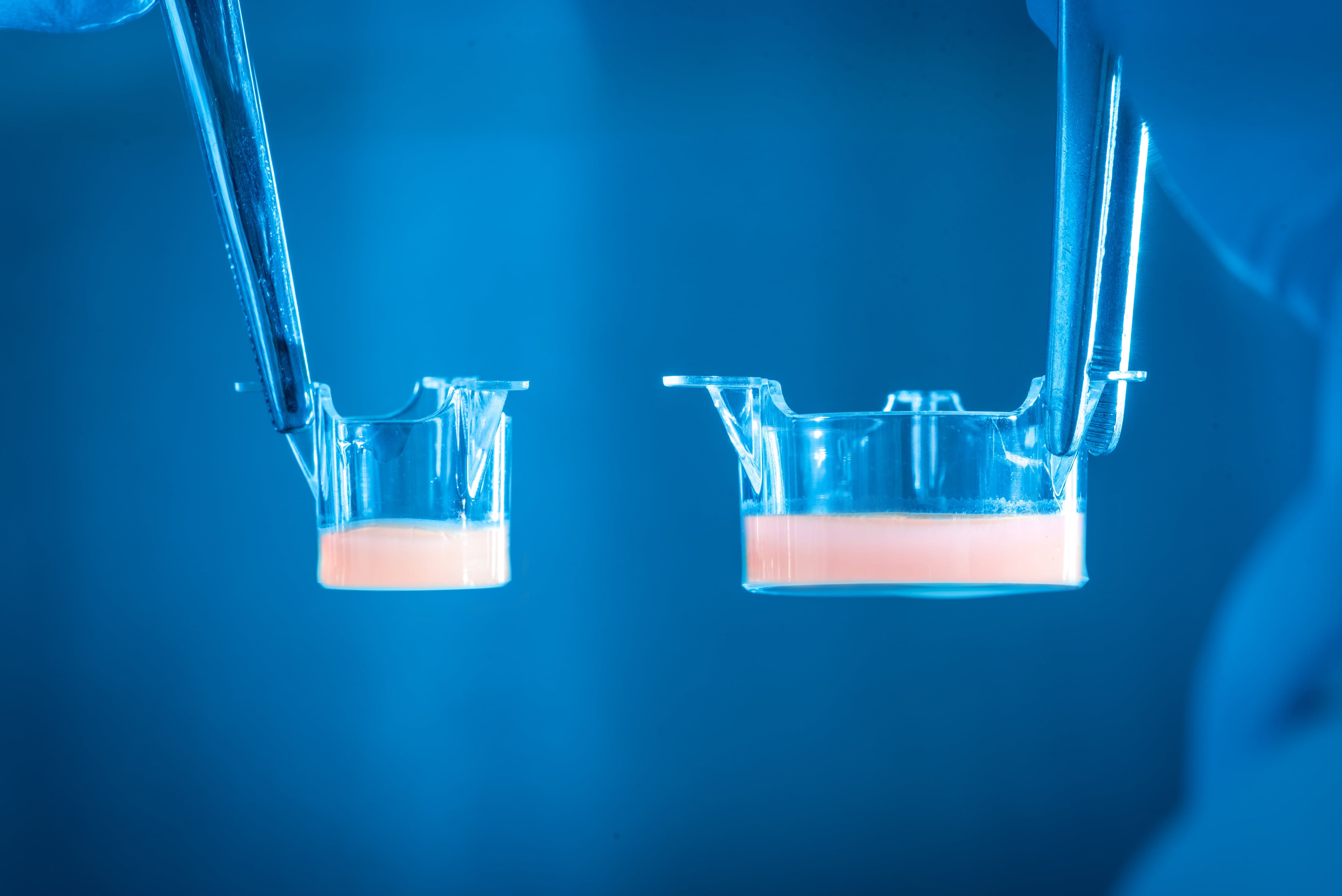 Labskin AI psoriasis skin model to fuel ‘breakthrough’ cosmetics category, says CEO
