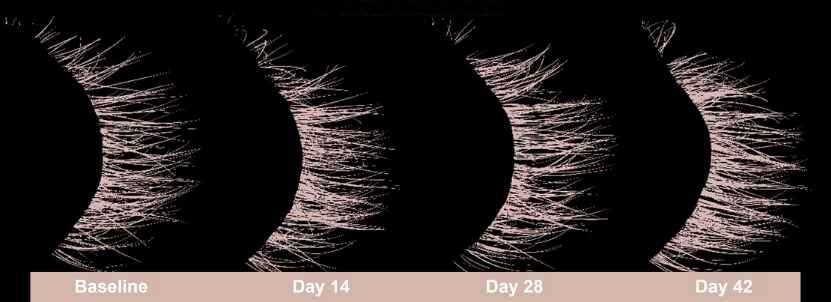 Eyelash density over 42 days