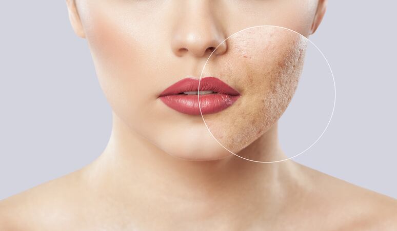 ‘Strategic’ microbiome move: DSM signs probiotic tech agreement with S-Biomedic