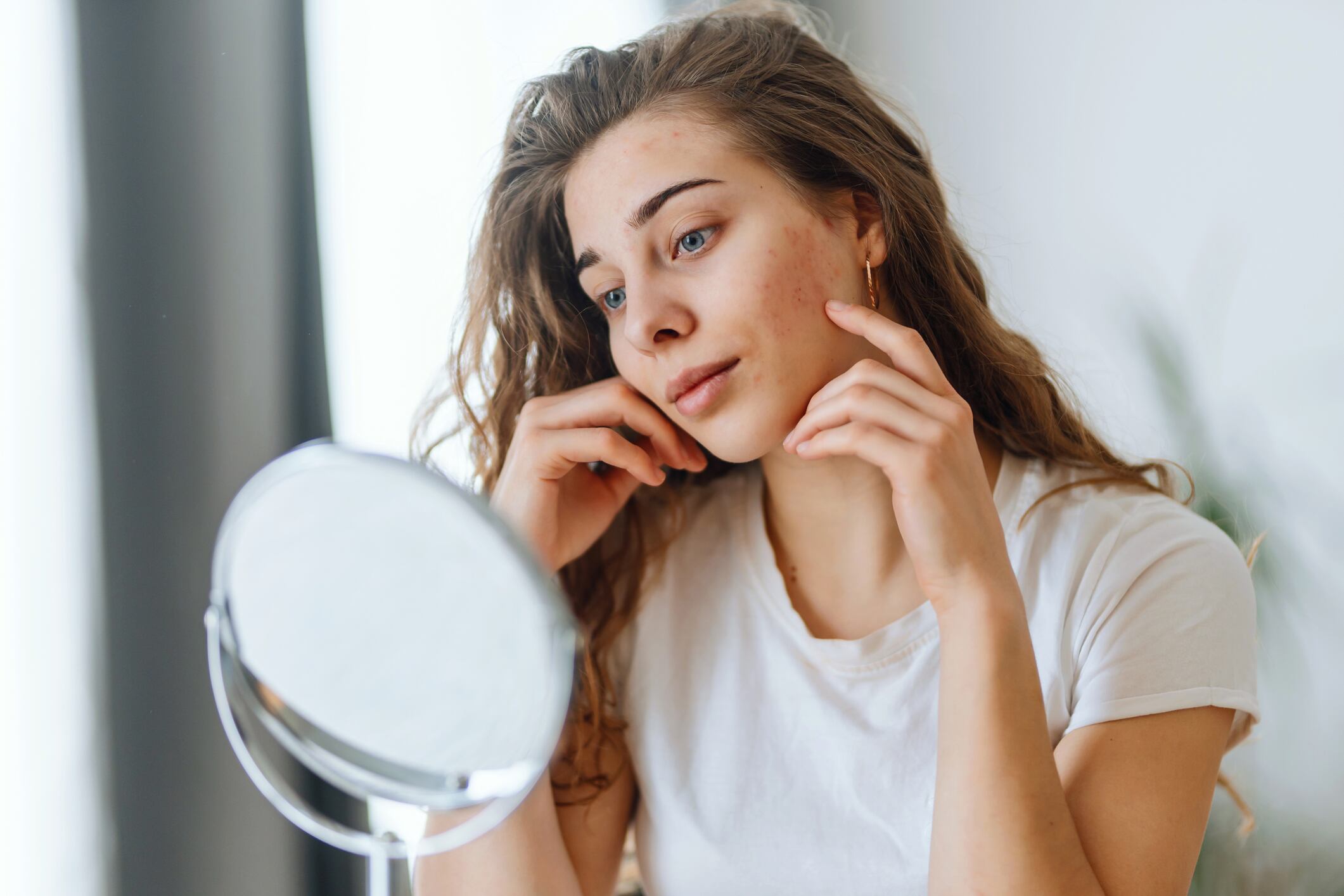 Lysine-dendrimer: a gentle yet effective acne treatment that maintains skin microbiome, says study