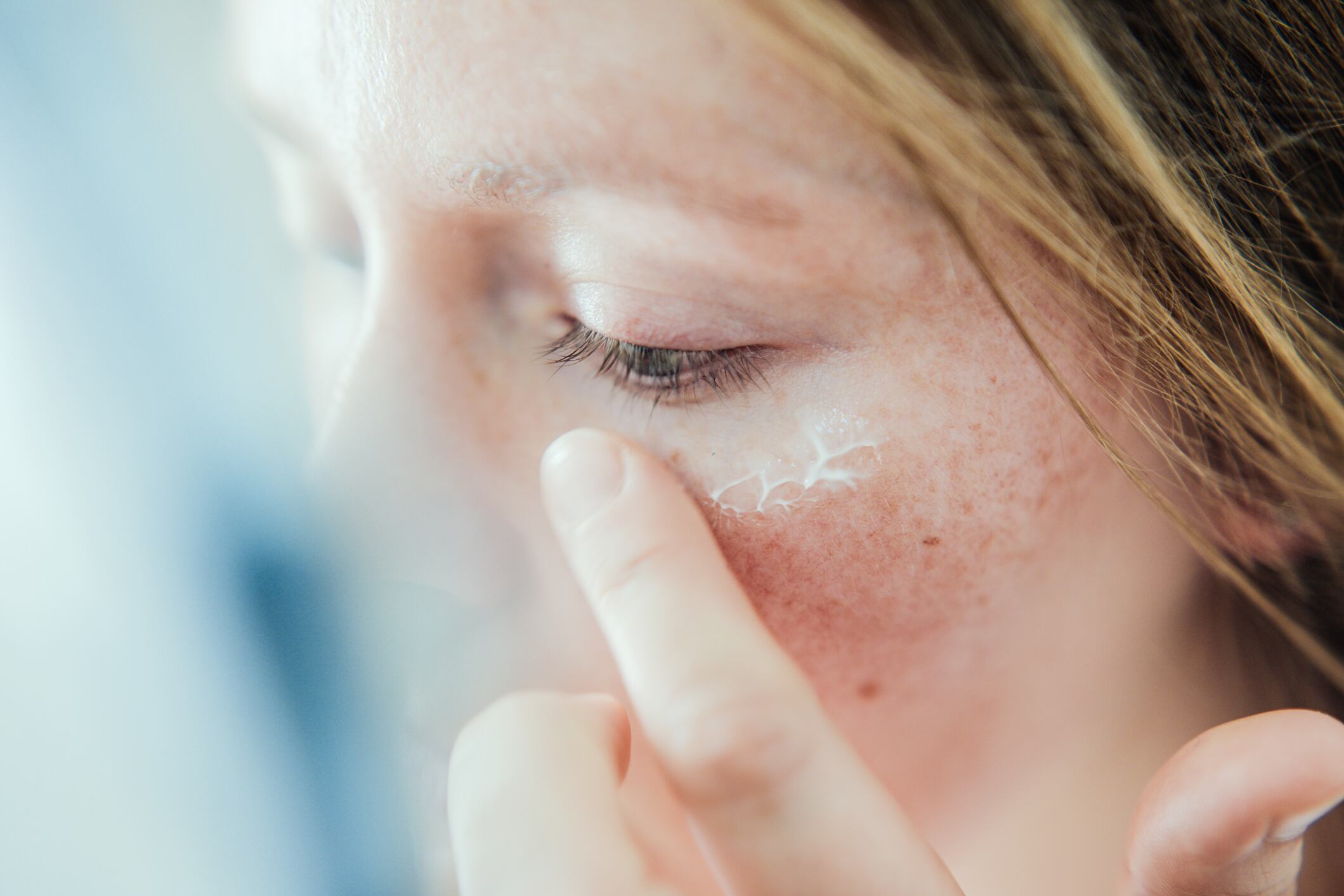 Root flavonoid extract shows promise in reversing visible effects of UVA photoaging on skin