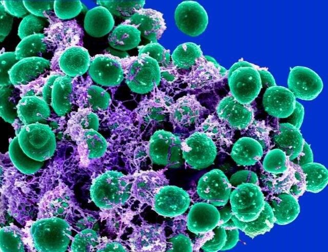 Bayer to develop medical skin care from staphylococcus epidermidis bacteria strains