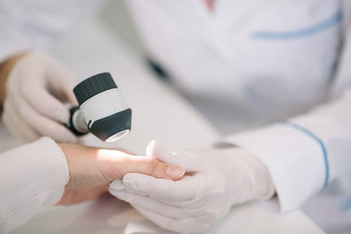 ‘Molecular missing link’: Research explains why some creams cause a skin rash