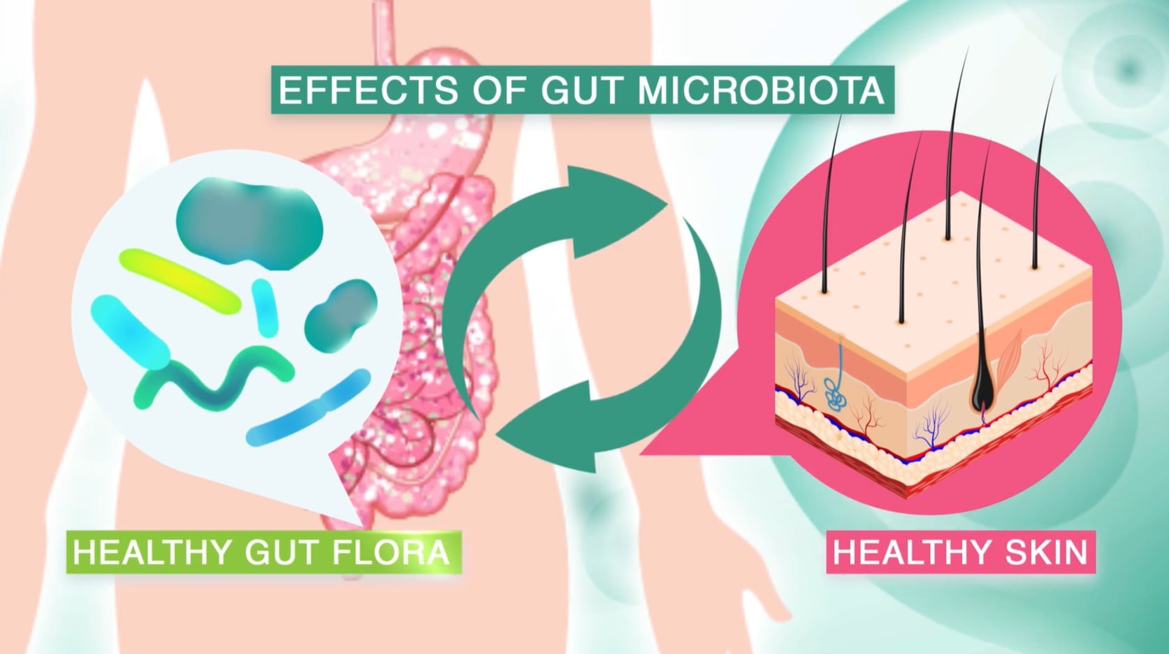 SkinBioTherapeutics launches probiotic supplement to target psoriasis