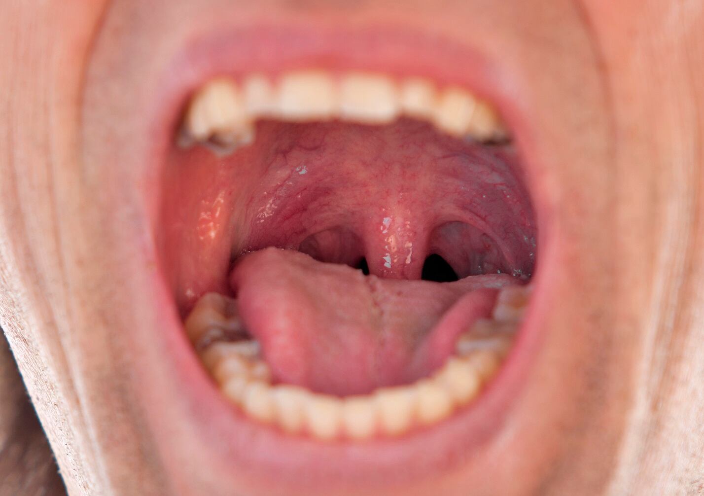Study identifies new oral probiotic candidate