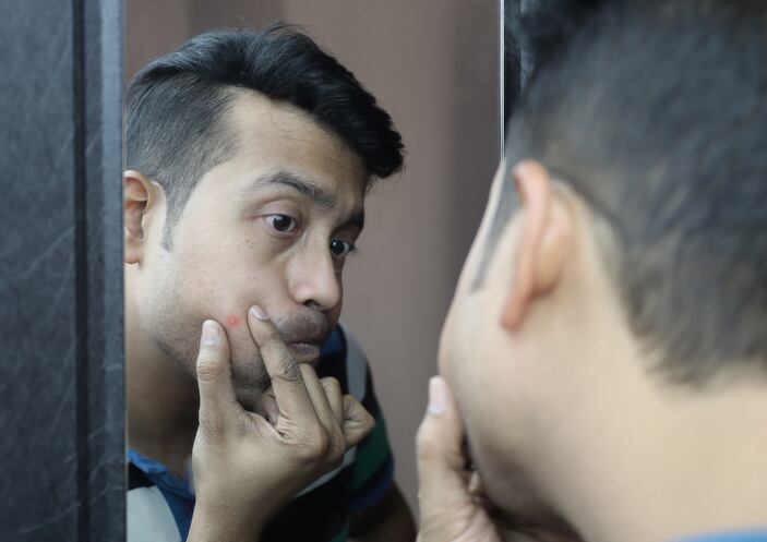 Acne-achievement-Postbiotic-achieves-same-results-as-standard-benzoyl-peroxide-treatment-Study.jpg