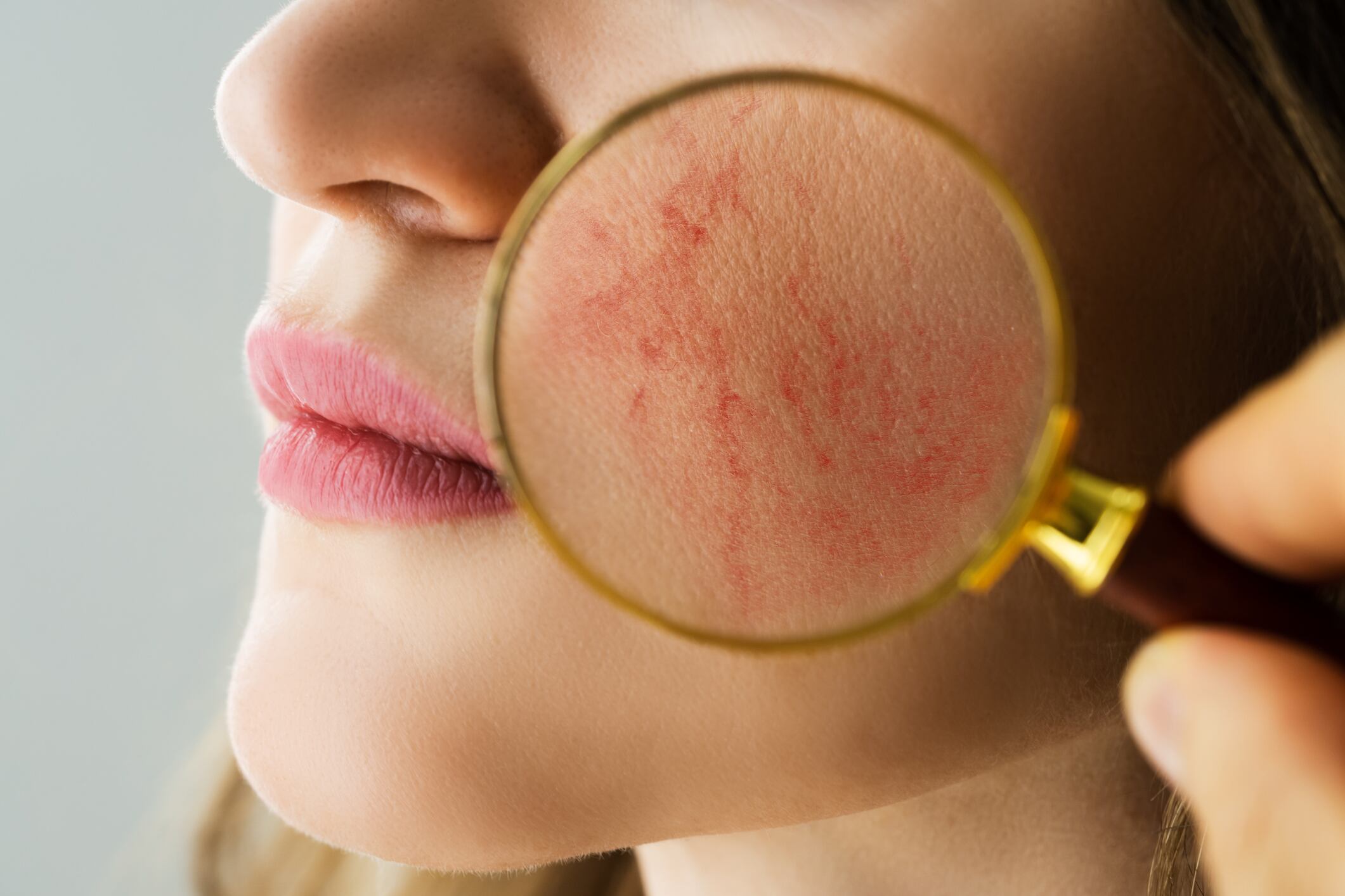 3-breakthroughs-that-could-treat-skin-redness.jpg