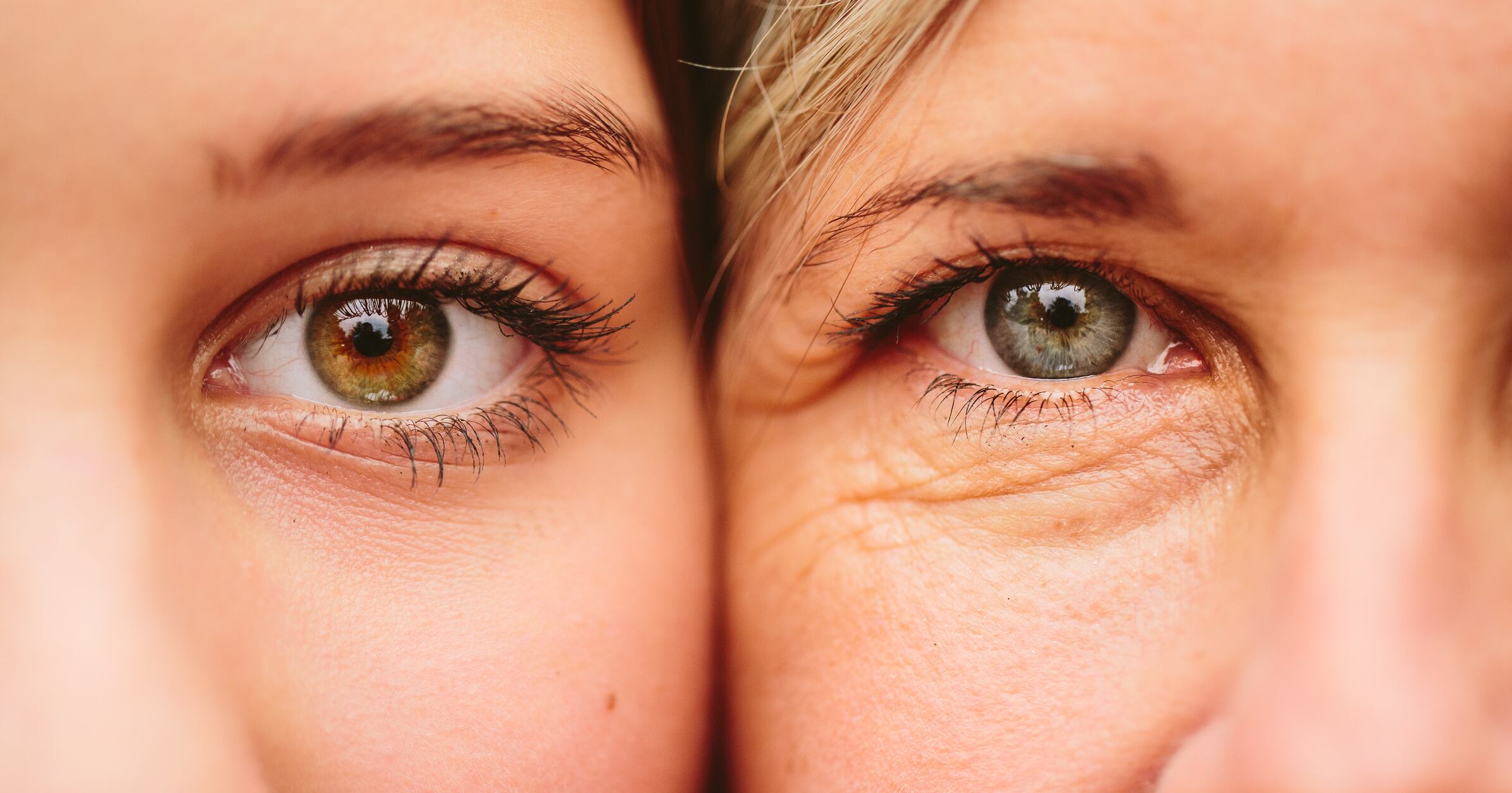 Global skin ageing indicators developed for Asian and Caucasian women – Clarins study