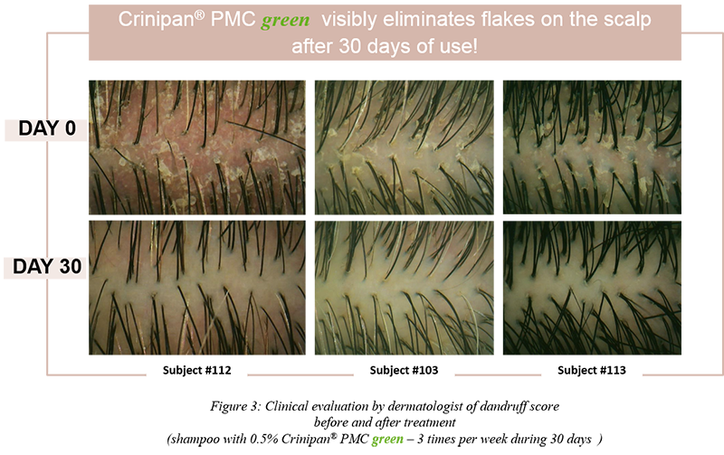 Figure-3-Crinipan-PMC-green_Article-CD-scalp-care-VF.png