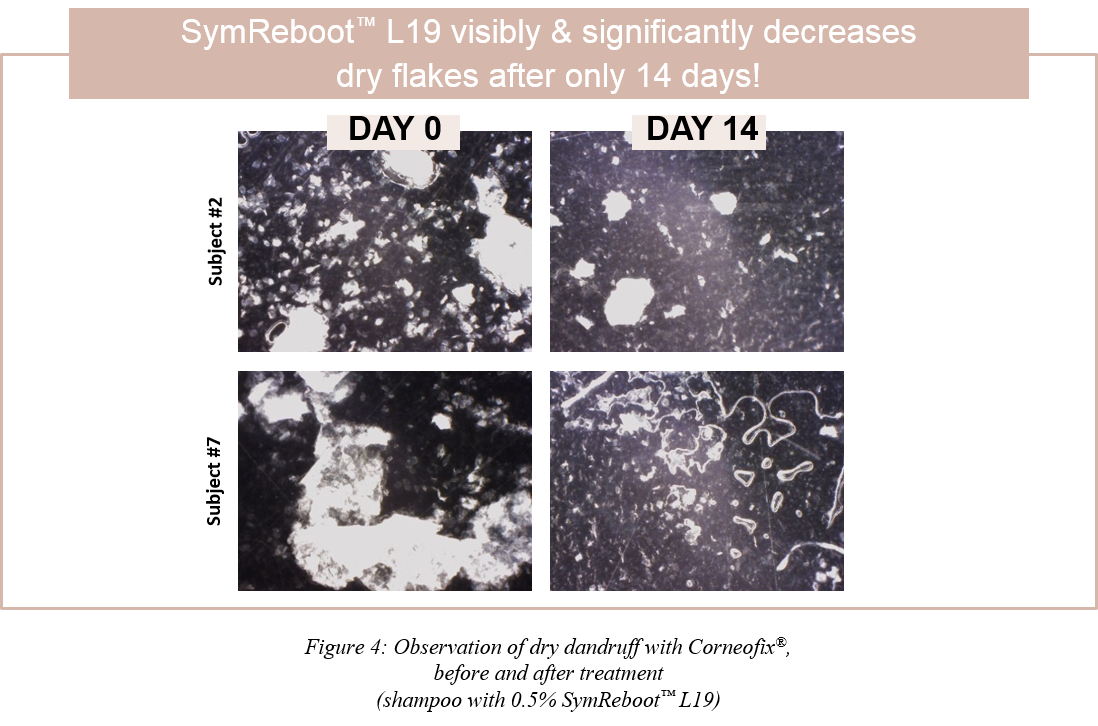 Figure-4-SymReboot-L19_Article-CD-scalp-care-VF.png