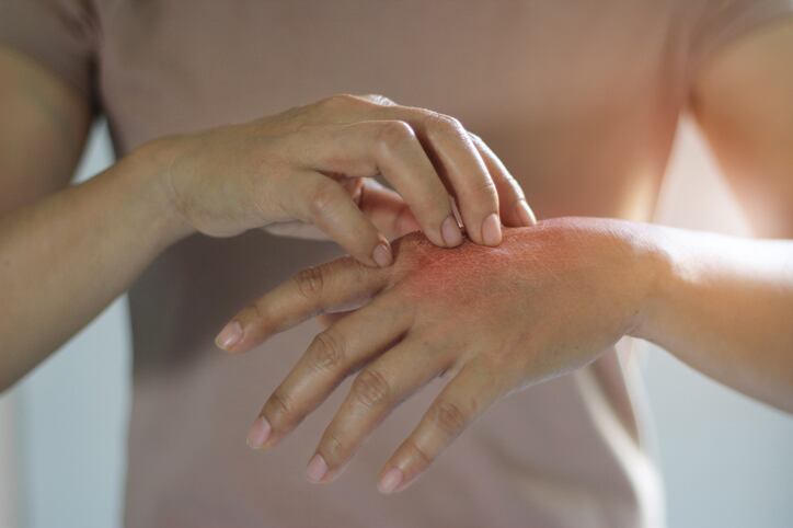 SCCS: Threshold for ‘contains formaldehyde’ warning in cosmetics not low enough