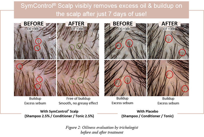Figure-2-SymControl-Scalp_Article-CD-scalp-care-VF.png