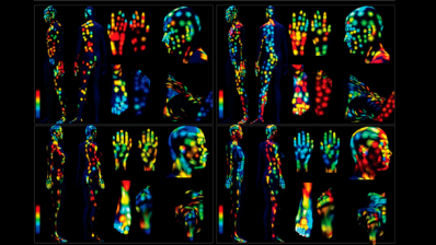 3D skin maps analyse skin behaviours and environmental exposures, past and present