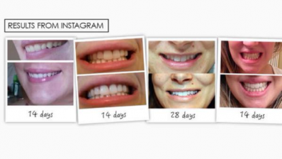 Teeth whitening ads branded misleading after claims ‘not sufficiently’ proved