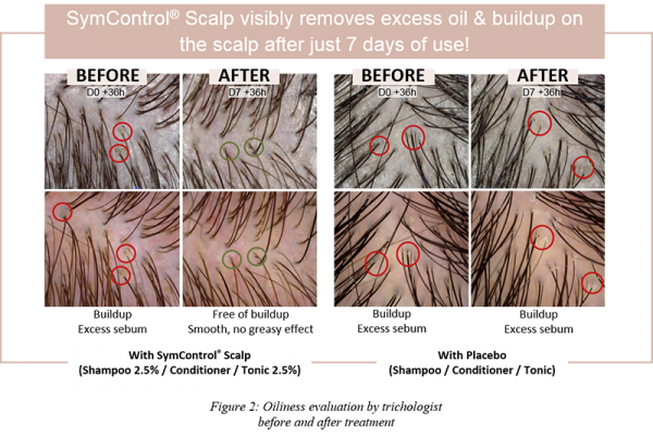 Figure 2 SymControl Scalp_Article CD scalp care VF