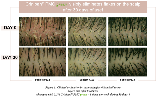 Figure 3 Crinipan PMC green_Article CD scalp care VF