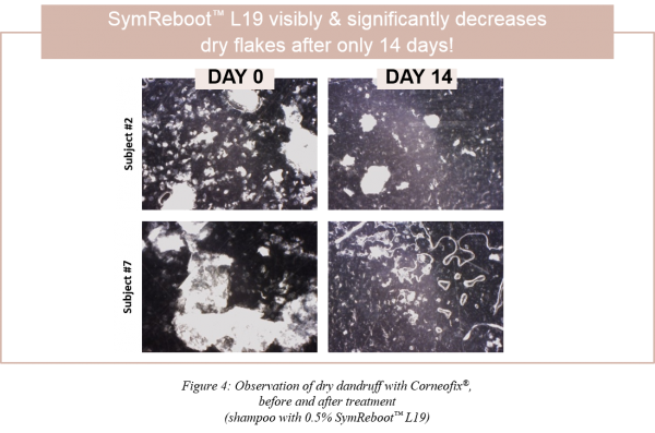 Figure 4 SymReboot L19_Article CD scalp care VF