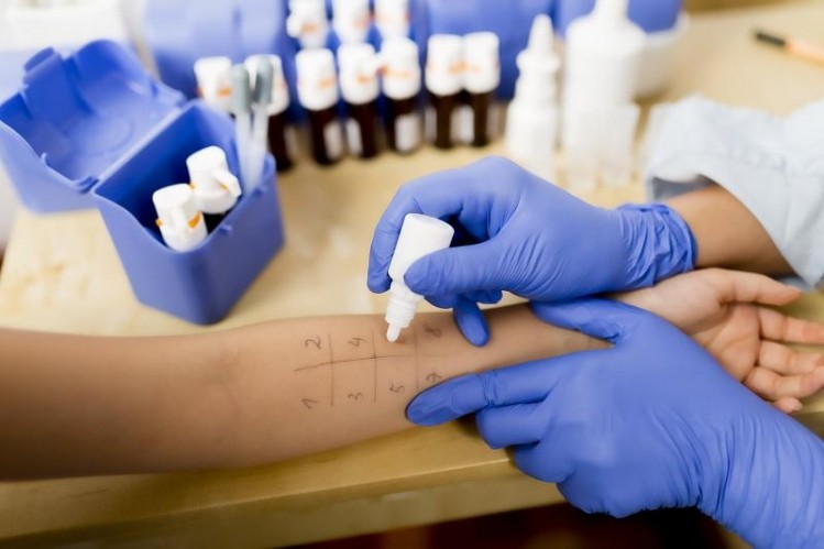 JRC science hub recommends new skin allergy test