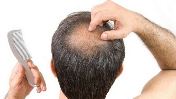 Stem cells hold key to hair regrowth