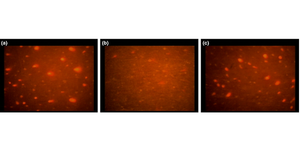 Typical evolution of Visiopor follicular fluorescent dots (a) before one application of a sunscreen, (b) immediately after application, and (c) a couple of hours later.