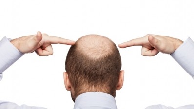 Studies further explain stem cell effects on hair growth