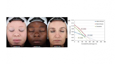 DSM gains further understanding of pigmentation’s role in skin repair